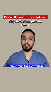 47K views · 505 reactions | Signs and symptoms of poor blood...