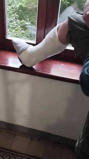 #legcast #ingessata #yeso #gipsbein #twistedankle #slwc #gesso #ugipsu #wgipsie #gipsz #legcast #walkingcast #platre #plaster #yeso #platre