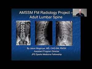 Lumbar Spine | MSK Radiology: X-Ray Educational Modules for Primary Care Residents