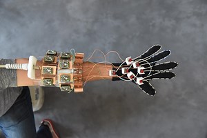 New "MRI Glove" for Bone and Joint Visualization | Clinical And Molecular Dx