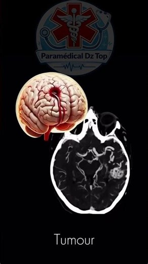 Brain CT Scan | Scanner cérébral #hospital #france #healthcare #medicalstudent #santé