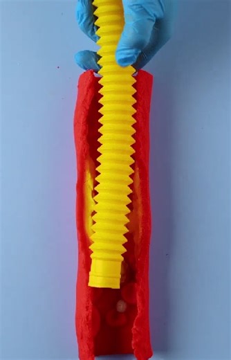 8.9K views · 35 reactions | Life-Saving Medical Procedures Explained | Health is Wealth | Facebook