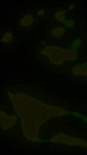 Shawn Mendes - Treat You Better: Slowed Reverb Edit