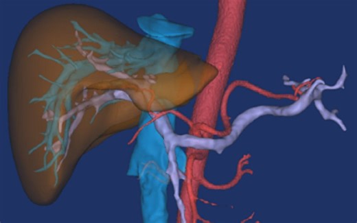 mimics19.0安装视频教程