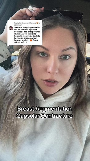 Understanding Capsular Contracture After Breast Augmentation