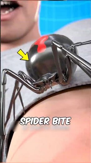If you ever get bitten by a spider, here’s what you need to know