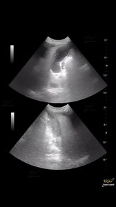 COMMENT ON GALLBLADDER 😲 😲 #firstweek #groupactivity #CommunityEvent #GroupMembers #charityevent #parenting #communityhealth #CommunityGathering #onlinecommunity #communitysupport #ultrasound #radiology #ultrasoundtech #gallbladder #gallbladdersurgery #gallbladderremoval | Ultrasound report expert