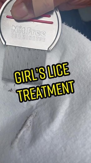 Girls Lice Treatment #lice #licetok #liceinfestation #piojos #liceremoval #hair #smallbiztok #foryou