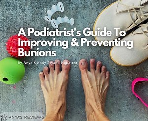 How To Help Your Bunions If You Don't Want Surgery | Anya's Reviews