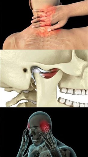 Your TMJ (temporomandibular joint) connects your jaw to your skull.