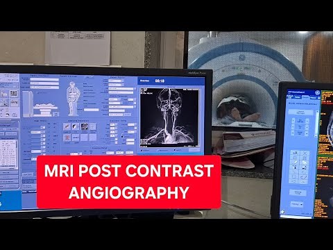 MRI Head & Neck Post contrast Angiography | TRICKS Technique | Live Practical Mri Training