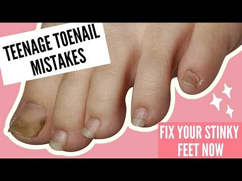 Teen Foot & Toenail Care | Prevent Ingrown Nails, Sports Injuries & More!
