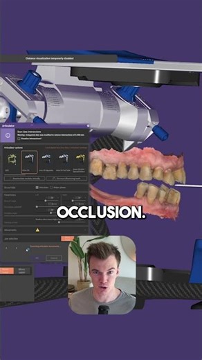 Want to design a Snap-On Smile in exocad?