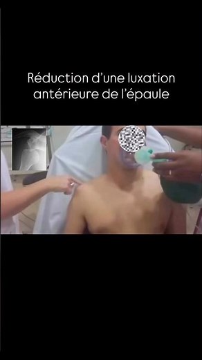 Reduction of a dislocated shoulder 🤕