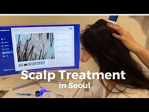 My scalp treatment experience in Seoul/scalp check-up/galvanic treatment/aqua punch