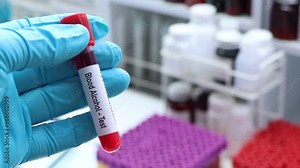 Blood Alcohol test to look for abnormalities from blood, blood sample to analyze in the laboratory, blood in test tube