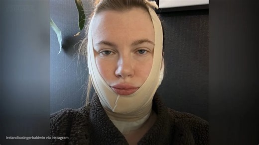 Ireland Baldwin hits back at critics of her recent cosmetic procedure