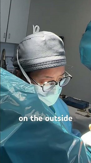 How Deviated Septum Surgery (Septoplasty) Helps You Breath Better? ...(3D Animation)#how #surgery