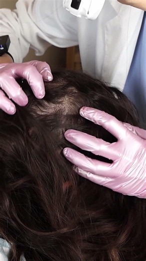 ASMR Satisfying Dry SCALP Treatment with Skin Analysis and Diagnostic ​#short #asmr #shorts