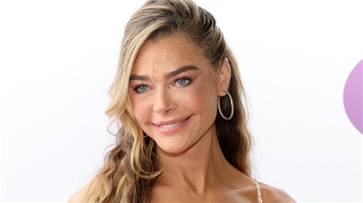 Denise Richards Drops Jaws in Before & After Facelift Photos