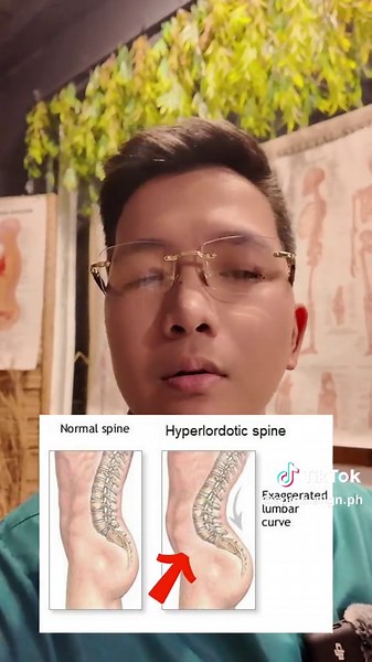 Iwasan po ang nakadapa matulog. Message us on our FB Page