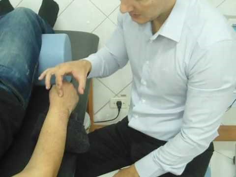 Scaphoid Bone Fracture Hand (Post-Operative - Manual Therapy) Dr. Robson Sitta Physiotherapy Clinic