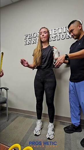 Trans-Humeral Myo-Electric Elbow and Wrist placement | Prosthetic Innovations