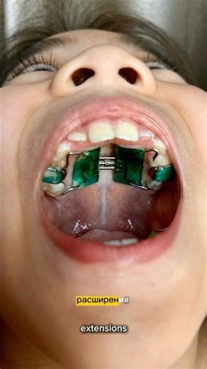 I Was Scared of This Tooth Machine… Until I Tried It🦷 #kids #toothbrush #dentalcare #teeth cleaning