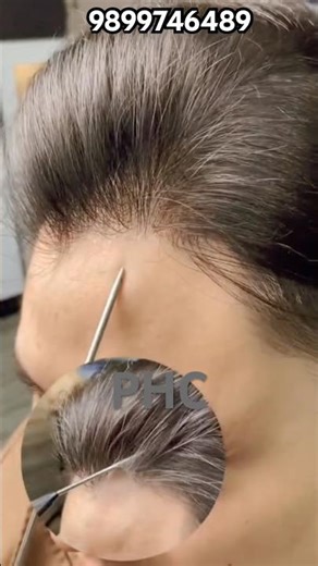 best quality hair patch for men Free demo and consultation ☎️ 9899746489 at reasonable price delhi