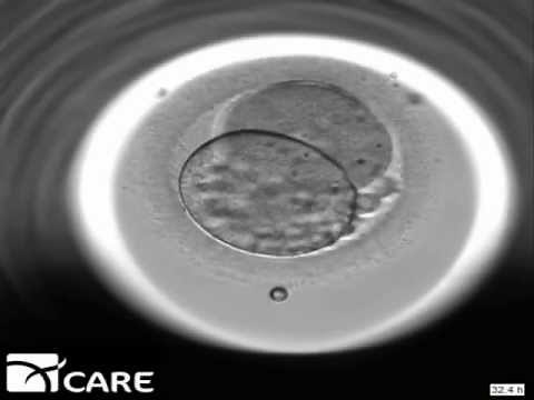 Time Lapse Embryo Imaging