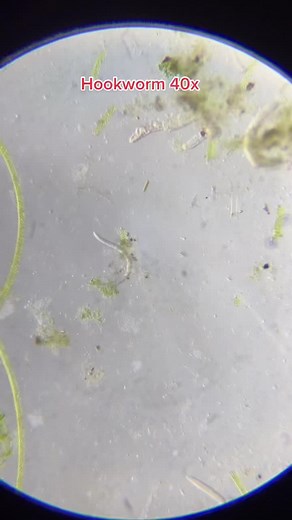 Exploring the Fascinating World of Hookworms Under the Microscope