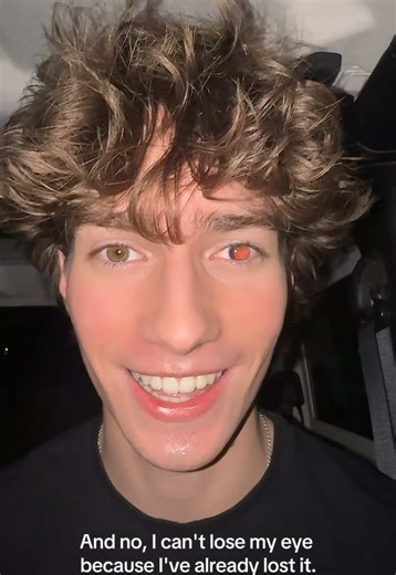 The Truth Behind Glowing Eyes in Photos