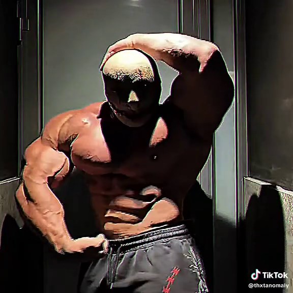 Genetic anomaly and limitless muscle growth — has anyone discovered it?
