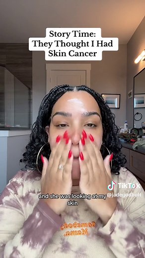 Understanding Small Moles and Skin Changes: A Dermatology Storytime