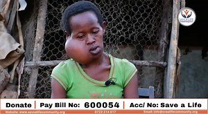 22 reactions | Catherine has been scheduled for surgery on Monday The metallic plate needed is 95k before Monday Let's do a a hundred bob challenge 100 Bob challenge to Paybill No. 600054 Account: Save a Life | Dr. Joseph Murimi - Save a Life Community | Facebook