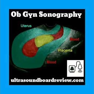Transvaginal Ultrasound