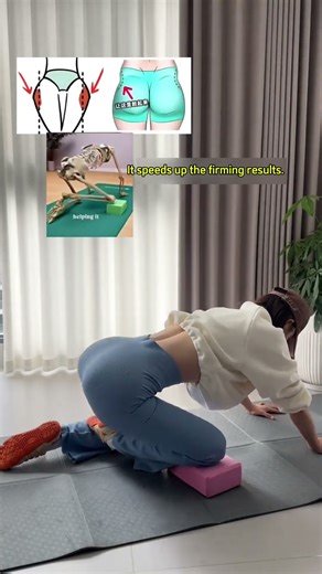 How to improve dimpled buttocks #exercise