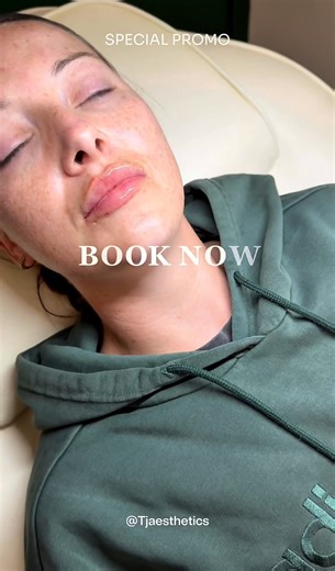 £20 off ALL treatment excluding anti wrinkle injection ALL Jan 💋 Limited appointment, book in now ❣️ | Tj Aesthetics