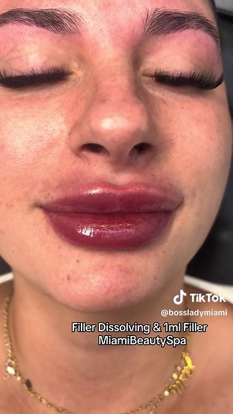 Come get pampered with us ❤️ Text us now for more information 📲786-495-2070 We’re in Miami ! Walk Ins Welcomed Open 6 Days ❤️CLOSED MONDAY ❤️ #MedSpaMiami #MedSpa #BodyContouring #MiamiSpa #MiamiBeautySpa