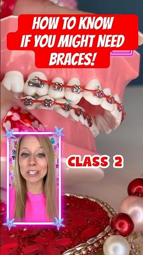HOW TO KNOW IF YOU MIGHT NEED BRACES? 🦷🧐 #braces #teeth #howto