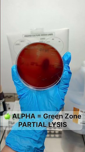 Blood Agar Plate Explained | Hemolysis Types in Microbiology (Alpha, Beta, Gamma)