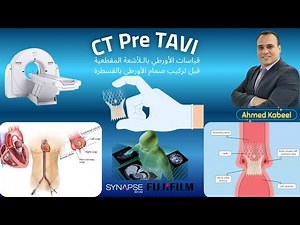 CT TAVI and Aortic Measurements قياسات الأورطي بالـلأشعة المقطعية قبل تركيب صمام الأورطي بالقسطرة