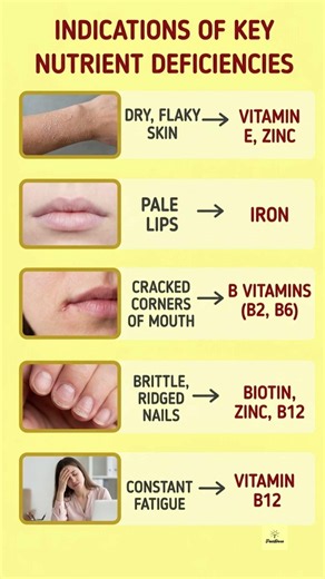 The Signs Your Body is Screaming: A Guide to Recognizing Nutrient Deficiencies