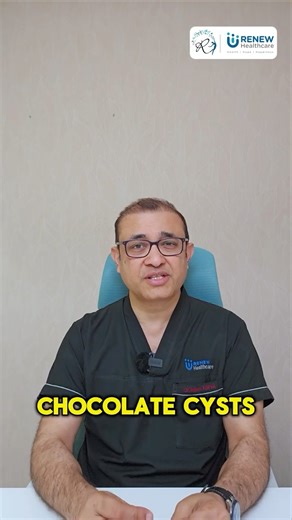 What Exactly Is A Chocolate Cyst?