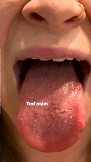 Sucho v ústech i přes dostatek tekutin může být následkem... Svěží dech, zdravé dásně a sebevědomý úsměv - přírodním způsobem! ✨ ✨ Vaše ústa jsou neuvěřitelný ekosystém, a když jsou v rovnováze, pocítíte rozdíl. Svěží a zdravá ústní dutina není jen o čištění zubů kartáčkem a zubní nití - začíná to správným druhem dobrých bakterií! Proto jsme vytvořili Oral Biotics - jednoduchý, přírodní způsob, jak podpořit zdraví ústní dutiny zevnitř. 💙 Přírodní cestou podporuje svěží dech 💙 Vyživuje zdravé d