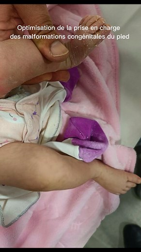 2.4K views | Optimisation de la prise en charge des malformations...