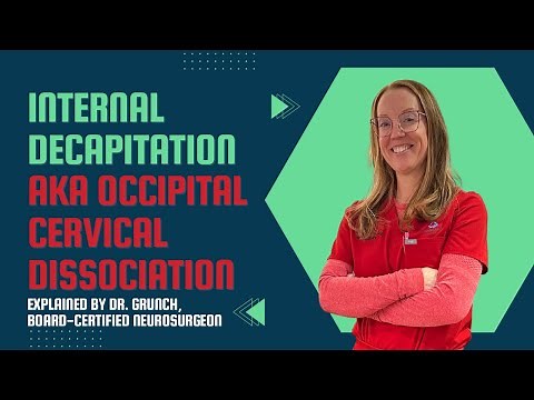 Case study 135 | Internal decapitation AKA OC dissociation | explained by Dr. Betsy Grunch
