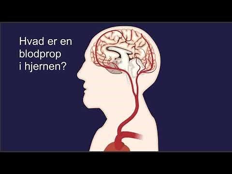 Hvad er en blodprop i hjernen?