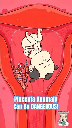 This Placenta Anomaly Can Be DANGEROUS! #pregnancy #animation