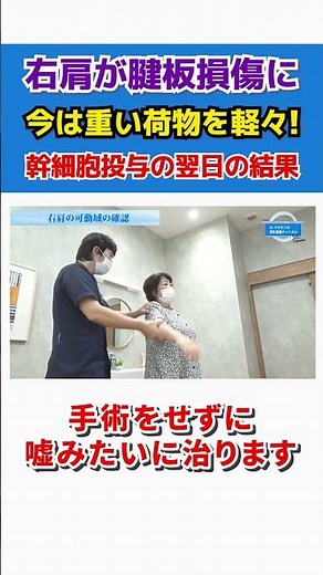 [Rotator cuff injury] I couldn't lift heavy objects, but after regenerative medicine, the pain is...